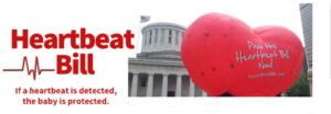 http://heartbeatbill.com/ http://heartbeatbill.com/